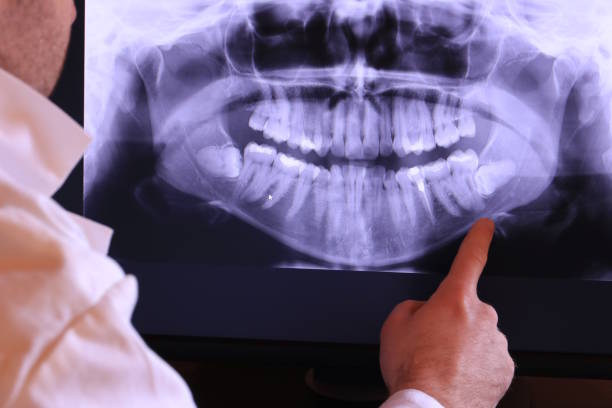 Best Holiday Emergency Dentist in Lead, SD