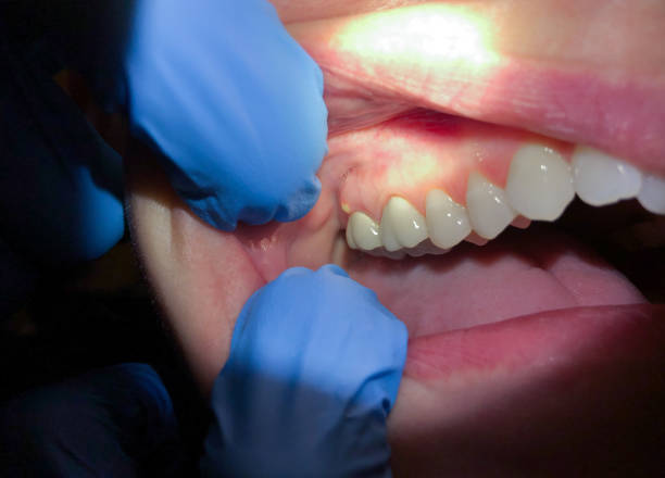 Best Pediatric Emergency Dentist in Lead, SD